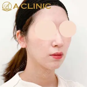 A CLINIC（エークリニック）横浜院の症例