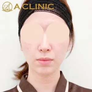 A CLINIC（エークリニック）横浜院の症例