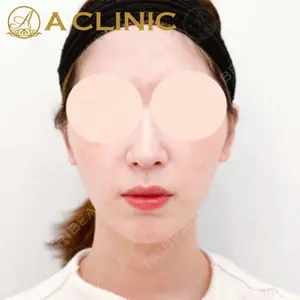 A CLINIC（エークリニック）横浜院の症例