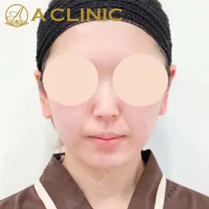 A CLINIC（エークリニック）横浜院の症例