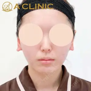 A CLINIC（エークリニック）横浜院の症例