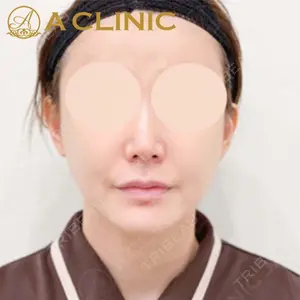 A CLINIC（エークリニック）横浜院の症例