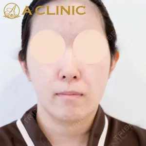 A CLINIC（エークリニック）横浜院の症例