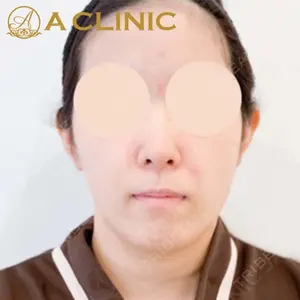 A CLINIC（エークリニック）横浜院の症例