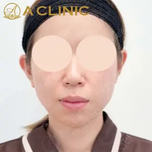 A CLINIC（エークリニック）横浜院の症例