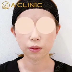 A CLINIC（エークリニック）横浜院の症例