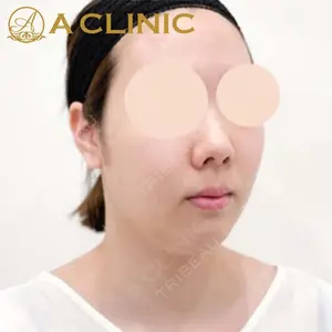 A CLINIC（エークリニック）横浜院の症例