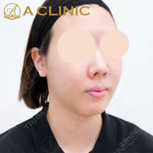 A CLINIC（エークリニック）横浜院の症例