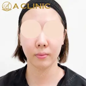 A CLINIC（エークリニック）横浜院の症例