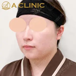 A CLINIC（エークリニック）横浜院の症例