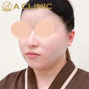 A CLINIC（エークリニック）横浜院の症例