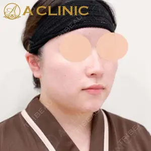 A CLINIC（エークリニック）横浜院の症例