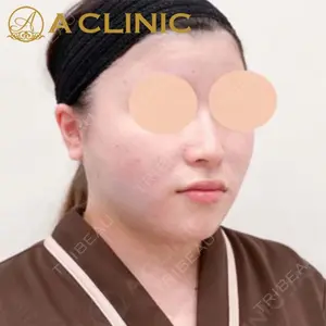 A CLINIC（エークリニック）横浜院の症例