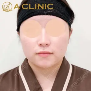 A CLINIC（エークリニック）横浜院の症例