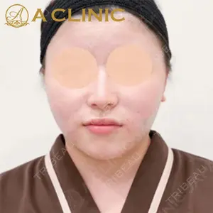 A CLINIC（エークリニック）横浜院の症例