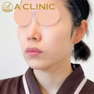 A CLINIC（エークリニック）横浜院の症例