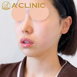 A CLINIC（エークリニック）横浜院の症例