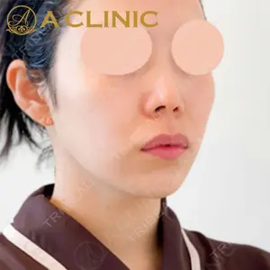 A CLINIC（エークリニック）横浜院の症例