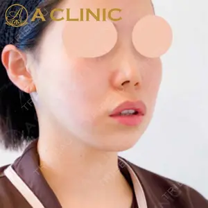 A CLINIC（エークリニック）横浜院の症例