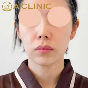 A CLINIC（エークリニック）横浜院の症例