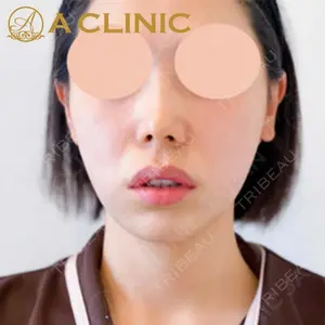 A CLINIC（エークリニック）横浜院の症例