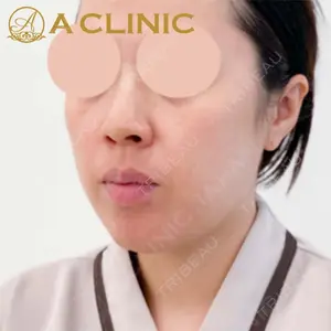 A CLINIC（エークリニック）横浜院の症例