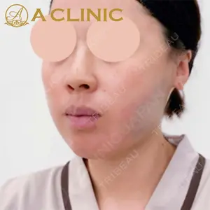 A CLINIC（エークリニック）横浜院の症例