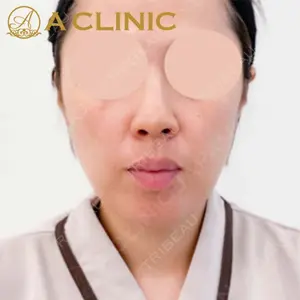 A CLINIC（エークリニック）横浜院の症例