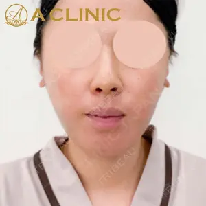 A CLINIC（エークリニック）横浜院の症例