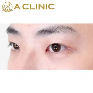 A CLINIC（エークリニック）横浜院の症例