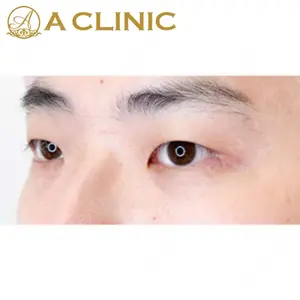 A CLINIC（エークリニック）横浜院の症例