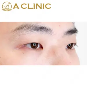 A CLINIC（エークリニック）横浜院の症例