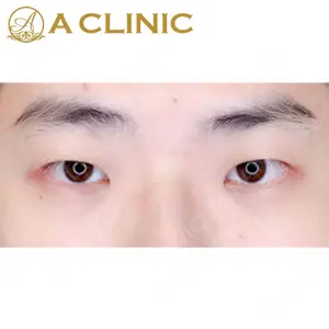 A CLINIC（エークリニック）横浜院の症例