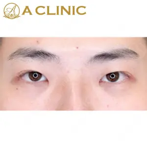 A CLINIC（エークリニック）横浜院の症例