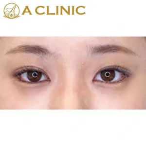 A CLINIC（エークリニック）横浜院の症例