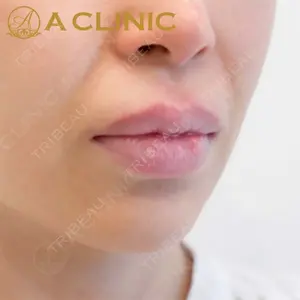 A CLINIC（エークリニック）横浜院の症例