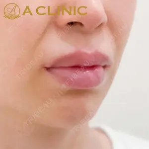 A CLINIC（エークリニック）横浜院の症例