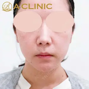 A CLINIC（エークリニック） 新宿院 片桐 大佑医師の症例