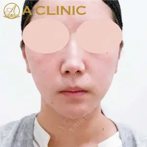 A CLINIC（エークリニック） 新宿院 片桐 大佑医師の症例