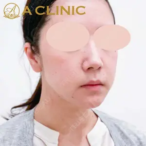 A CLINIC（エークリニック） 新宿院 片桐 大佑医師の症例