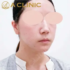 A CLINIC（エークリニック） 新宿院 片桐 大佑医師の症例