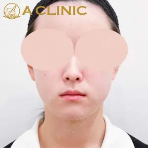 A CLINIC（エークリニック） 新宿院 片桐 大佑医師の症例