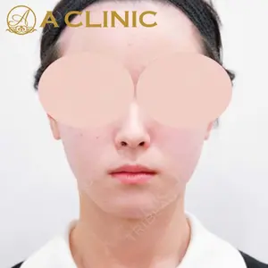 A CLINIC（エークリニック） 新宿院 片桐 大佑医師の症例