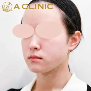 A CLINIC（エークリニック） 新宿院 片桐 大佑医師の症例