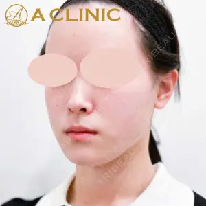 A CLINIC（エークリニック） 新宿院 片桐 大佑医師の症例