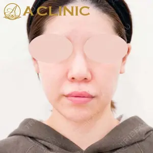 A CLINIC（エークリニック） 新宿院 片桐 大佑医師の症例