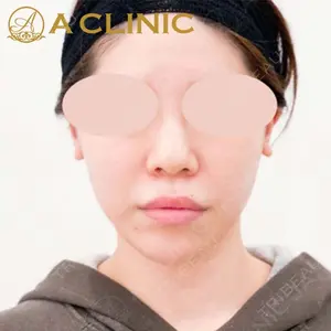 A CLINIC（エークリニック） 新宿院 片桐 大佑医師の症例