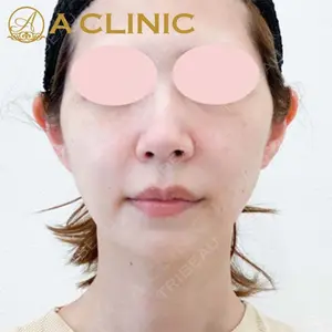 A CLINIC（エークリニック） 新宿院 片桐 大佑医師の症例