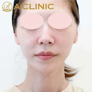 A CLINIC（エークリニック） 新宿院 片桐 大佑医師の症例