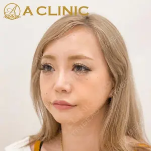 A CLINIC（エークリニック） 新宿院 片桐 大佑医師の症例